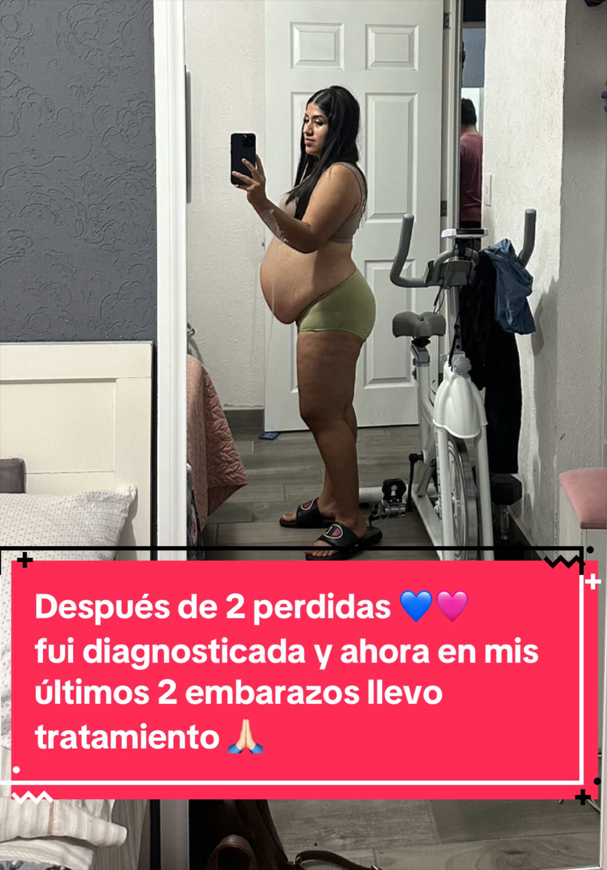 @Abi Martinez