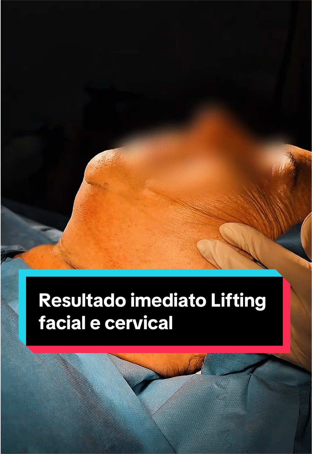 @Fernando Bianco