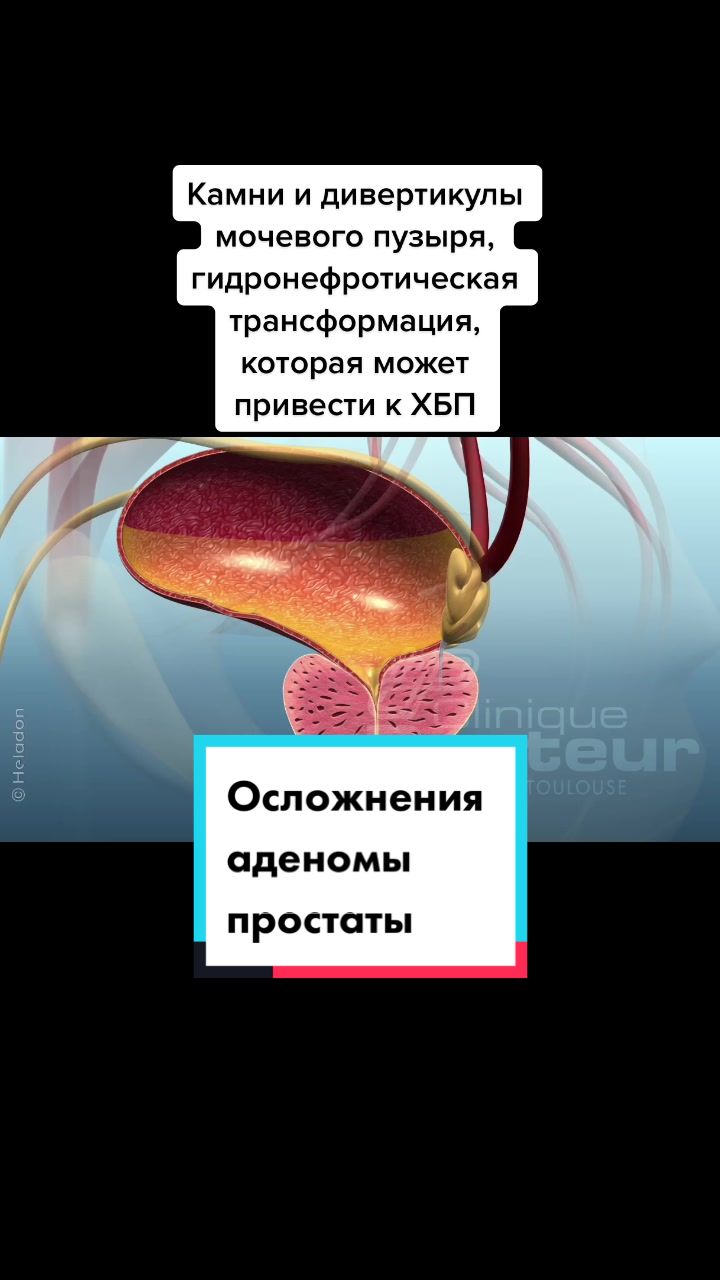 @Denis Davydov