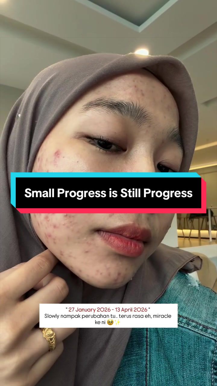 @AINAA Skincare Original