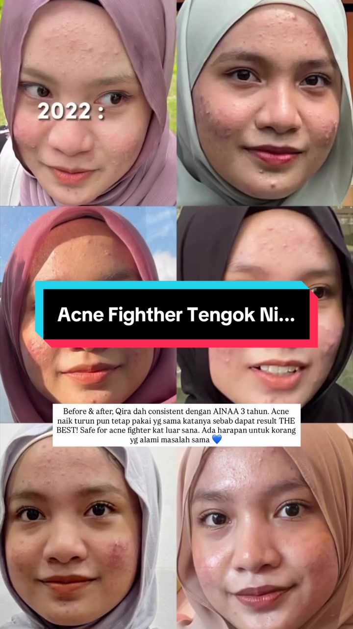 @Ainaa Beauty Zue
