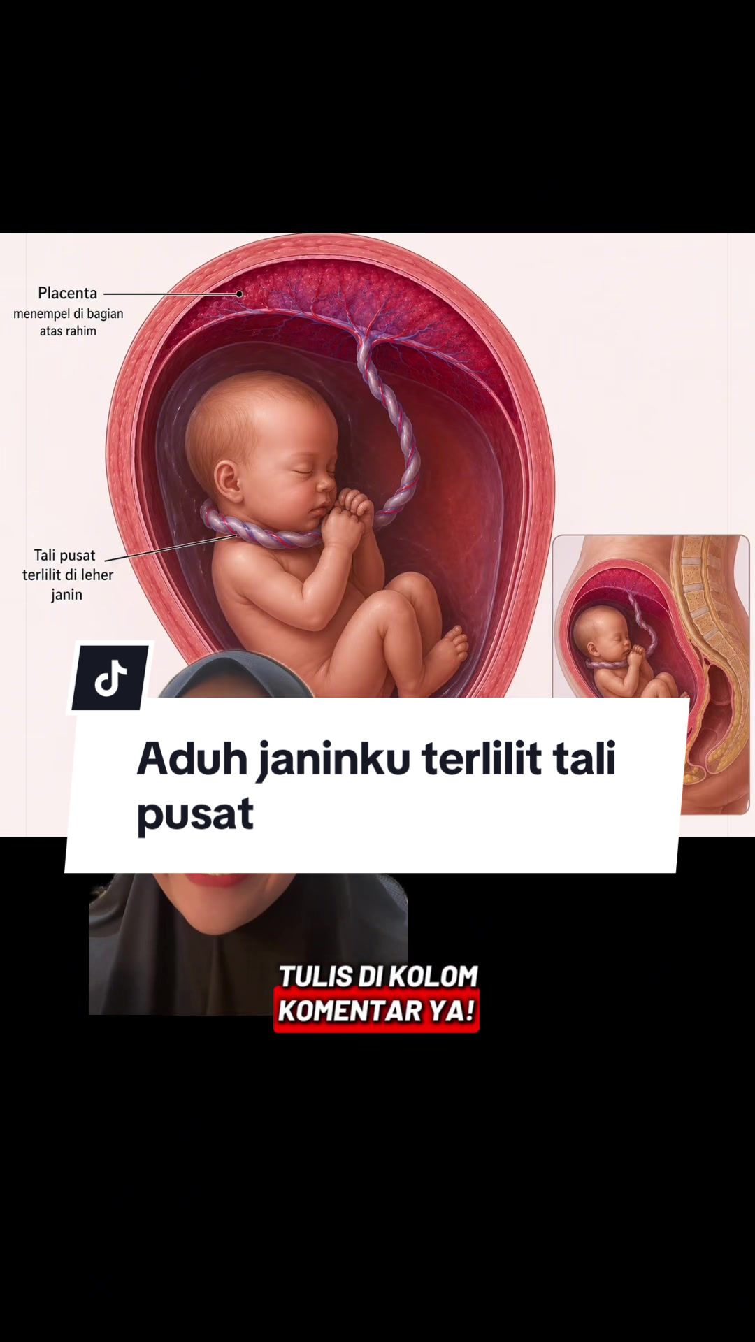 @Bidan Hilda | Prenatal Yoga
