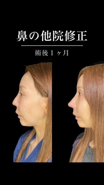 @ソ院長(バウム美容外科/トータル整形)