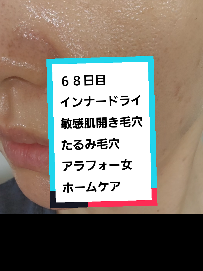 @リアル毛穴改善記録