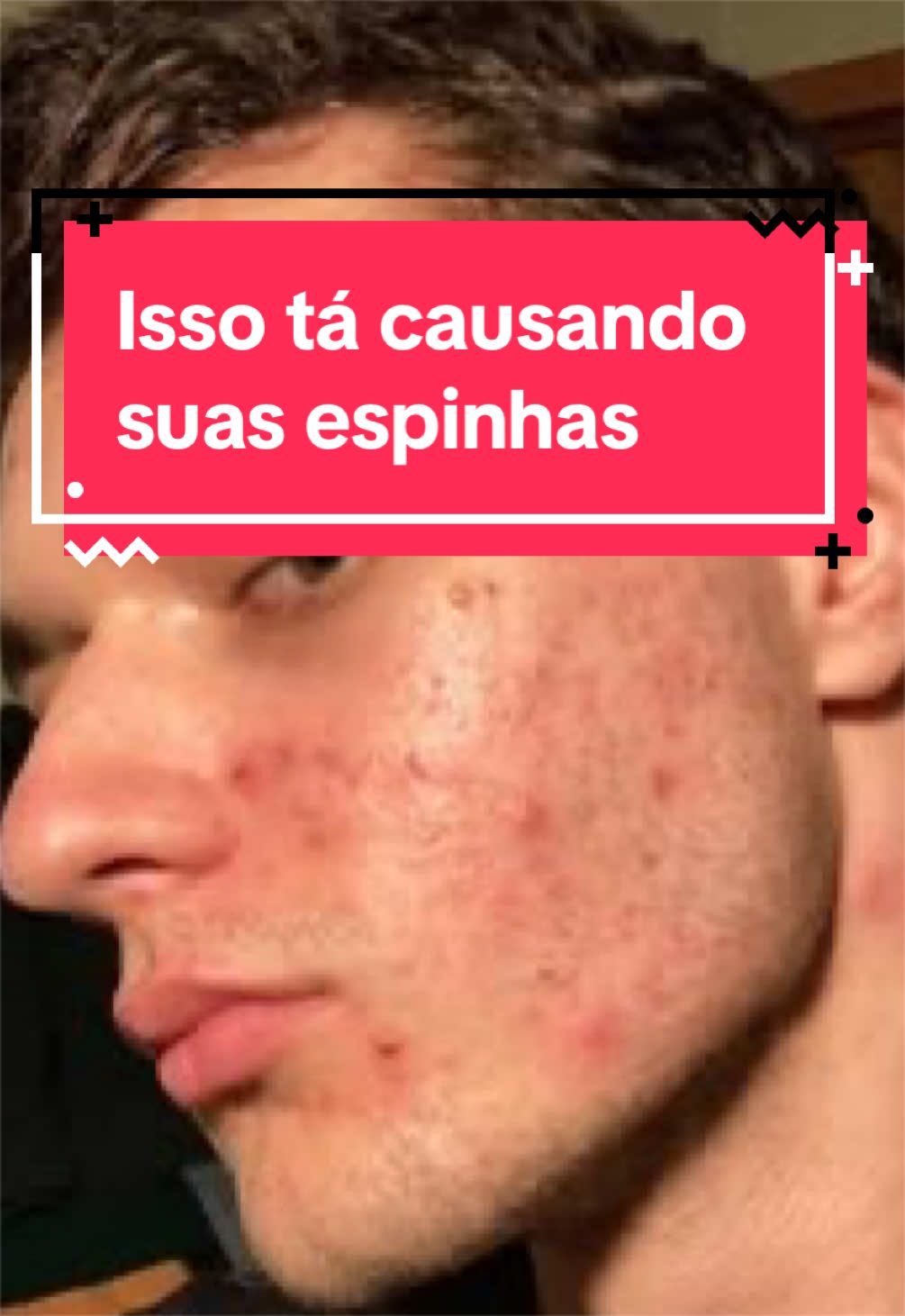 @looksmaxing Brasil