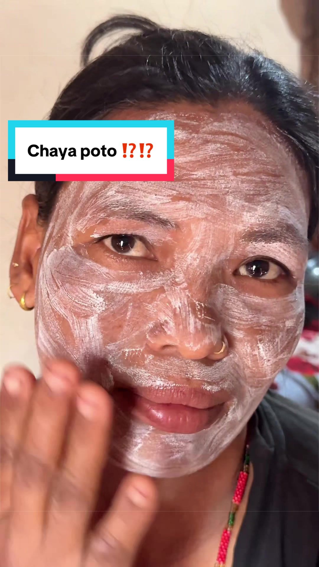 @Minimagic Skincare🇳🇵