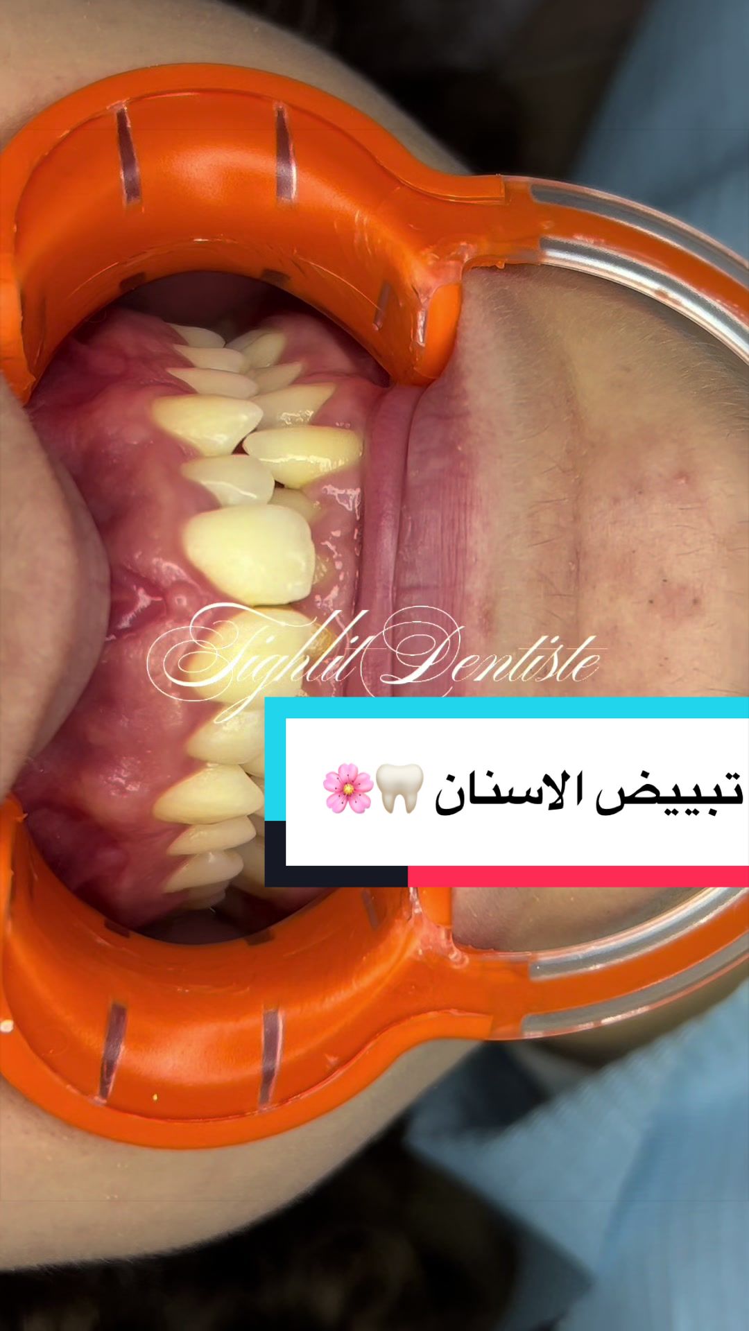 @tighlit_dentiste🦷