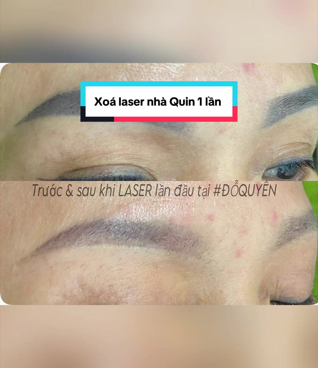 @PHUN XĂM ĐỖ QUYÊN