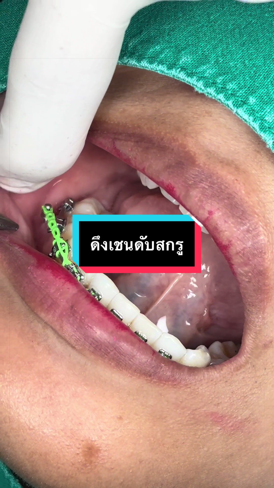 @ซอฟแอนด์สไมล์ลาดกระบัง
