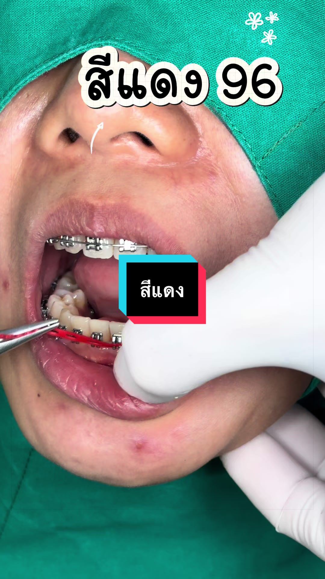 @ซอฟแอนด์สไมล์ลาดกระบัง
