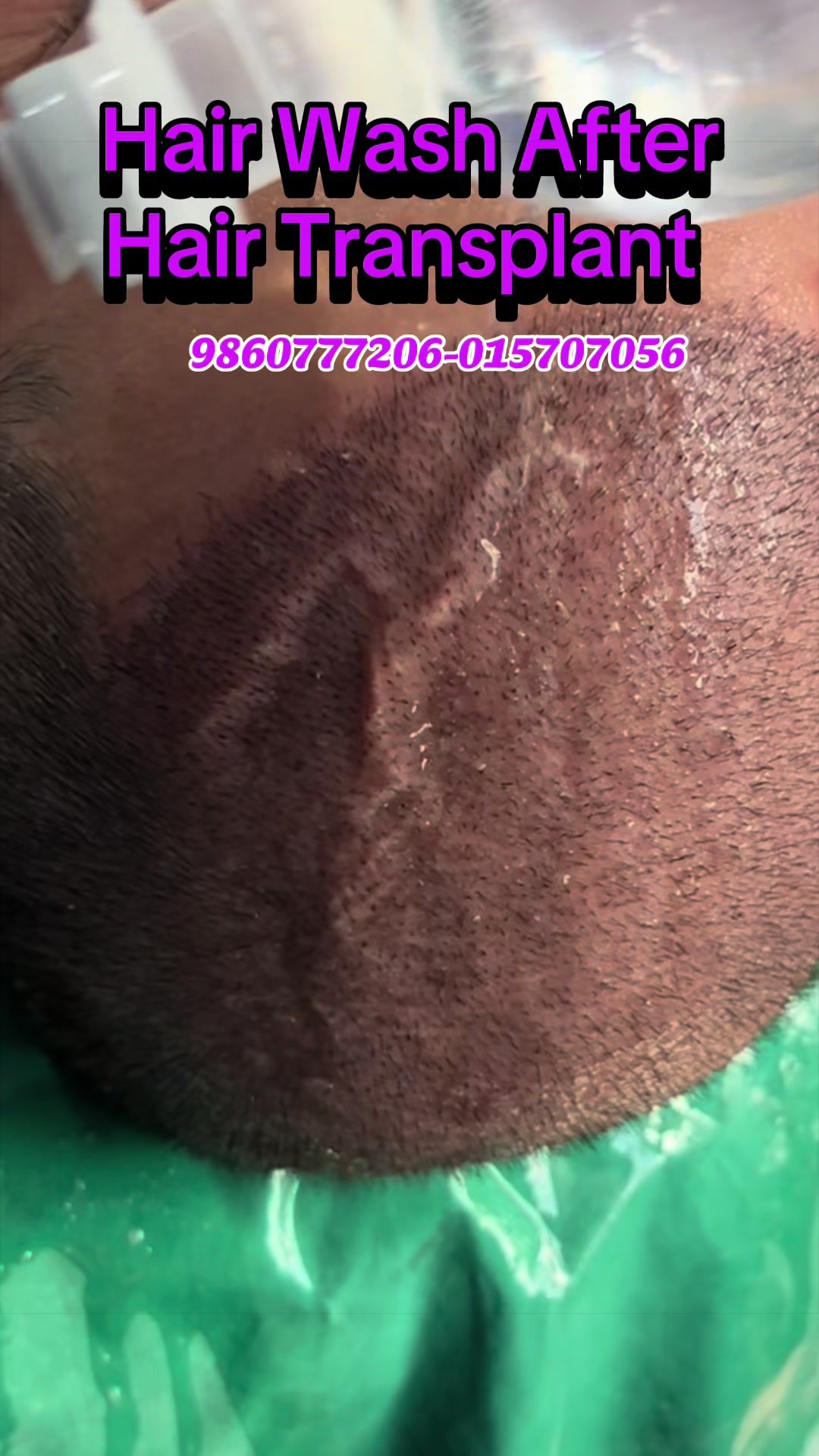 @Dr. Mainali, plastic surgeon