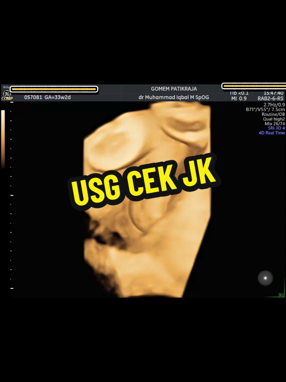 @USG 4D PATIKRAJA