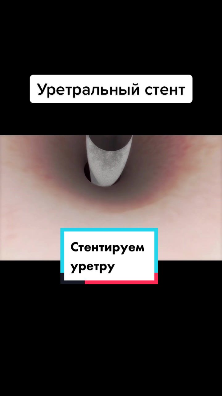 @Denis Davydov