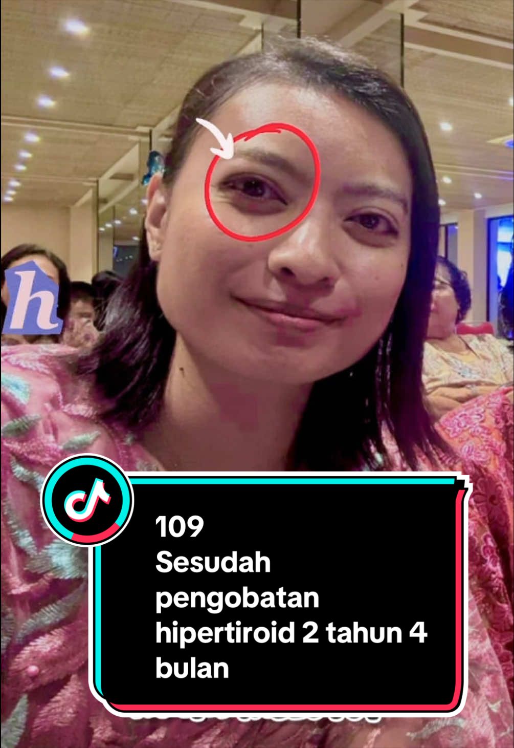 @Fionalois Pertiwi
