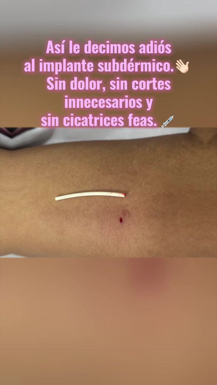 @FEM CENTER_de mujer a mujer