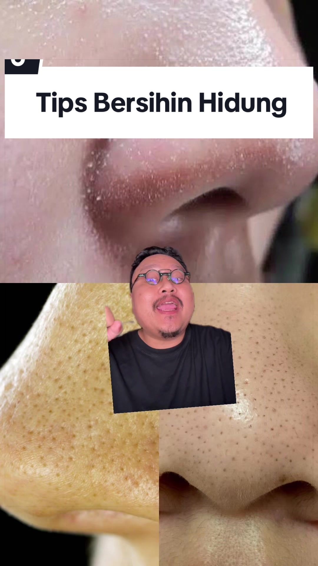 @Ali | @HungryForSkincare