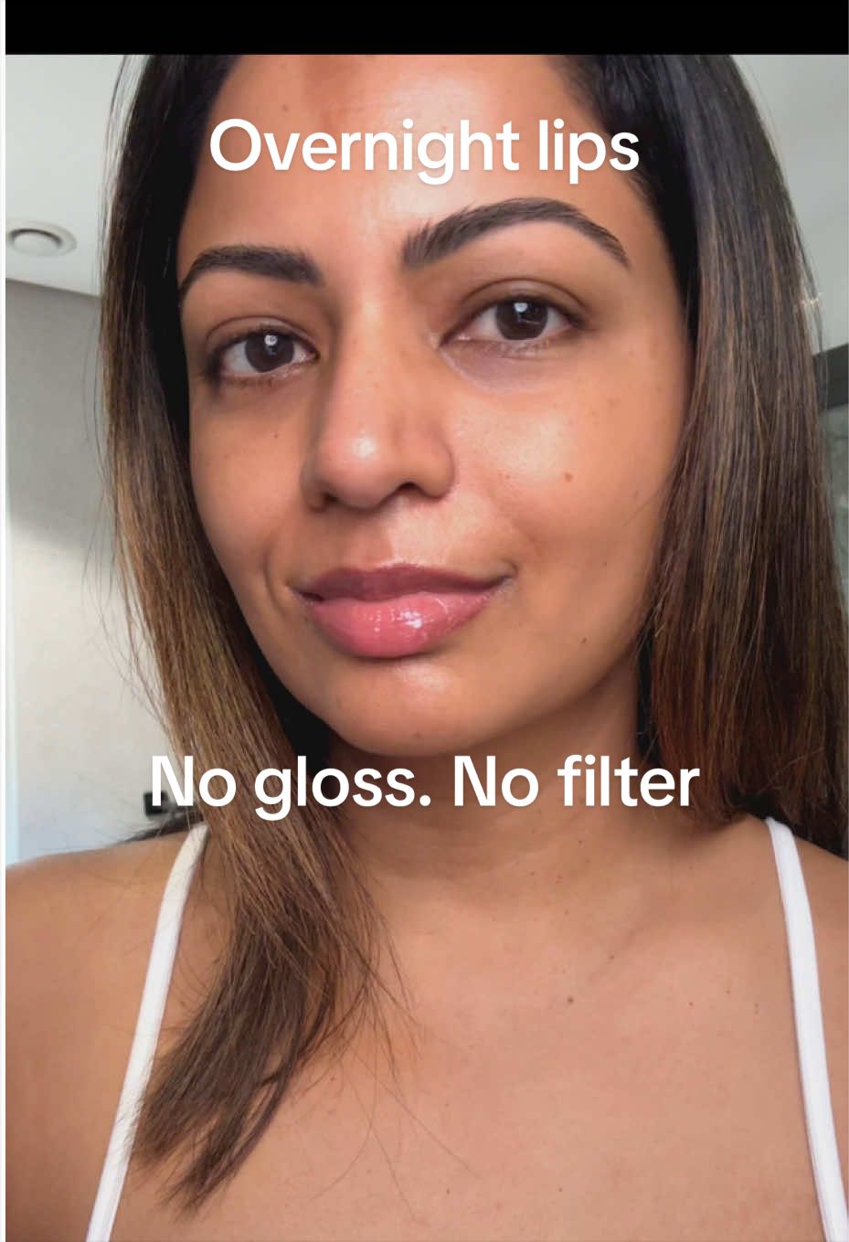 @Dee | Hyperpigmentation
