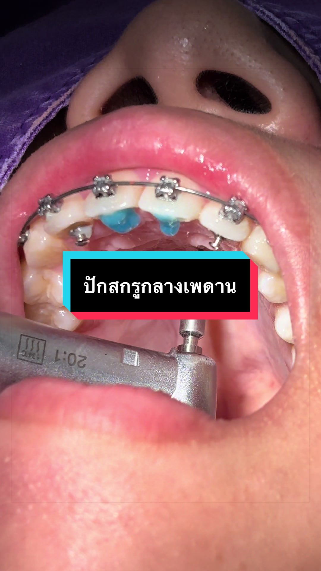 @ซอฟแอนด์สไมล์ลาดกระบัง