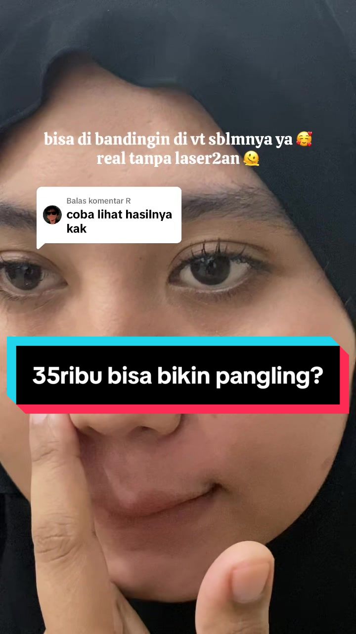 @Penghilangtahilalat.kaq.ay