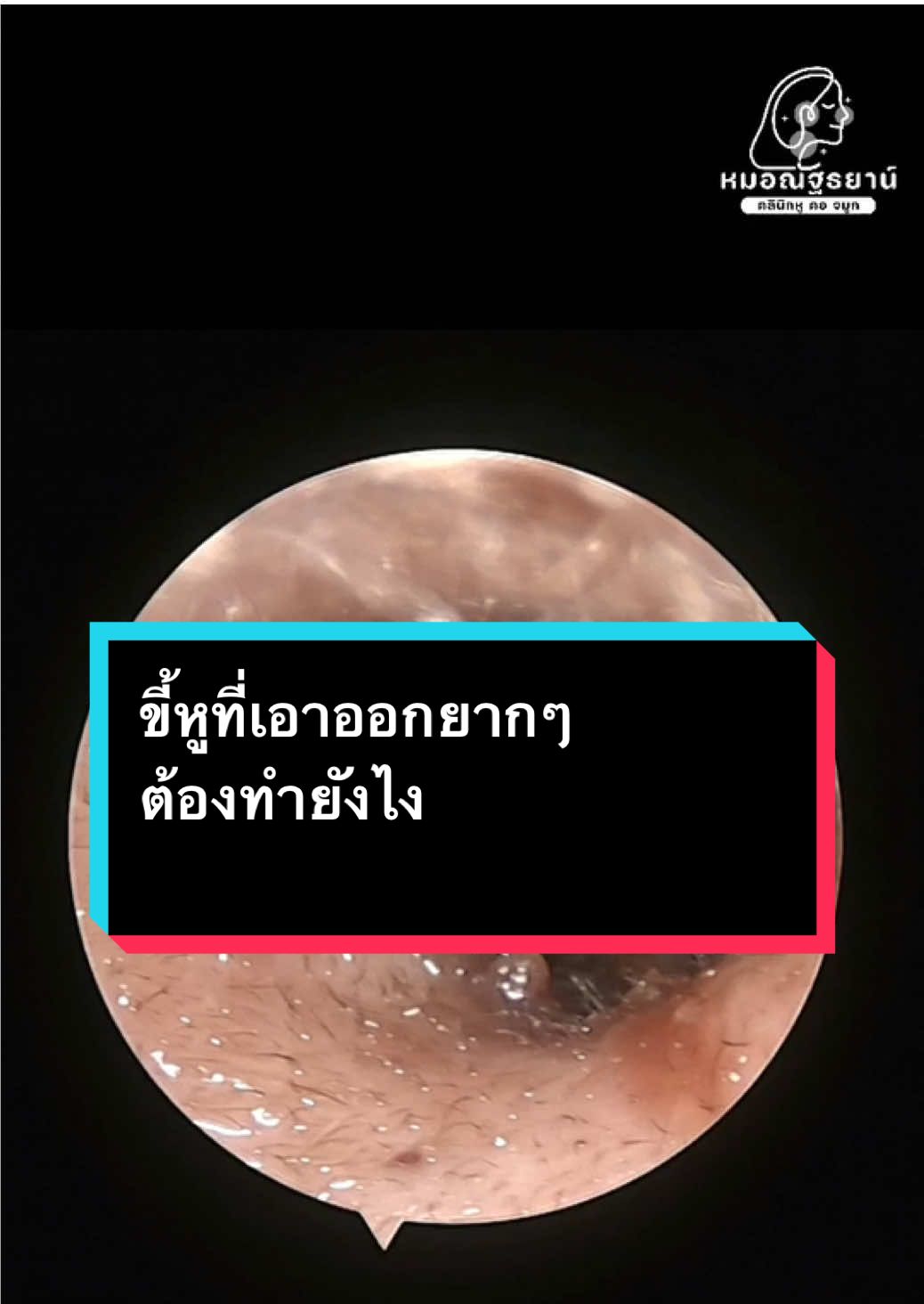@คลินิกหมอณัฐธยาน์ หู คอ จมูก