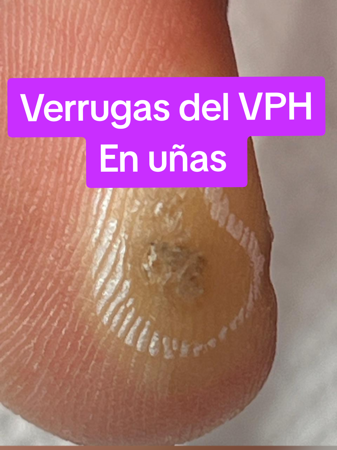 @VPH2025