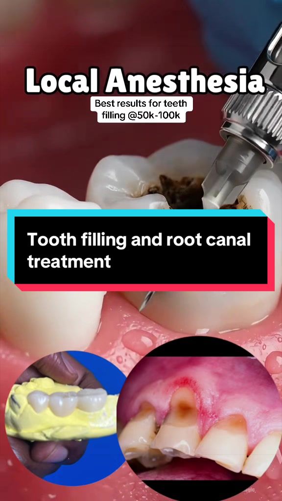 @Dr~MUJUNI 🦷🇺🇬✅