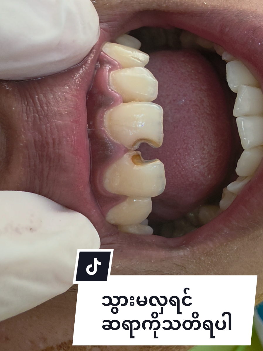 @Dr.KoKoSawMin(သွားဆရာဝန်)