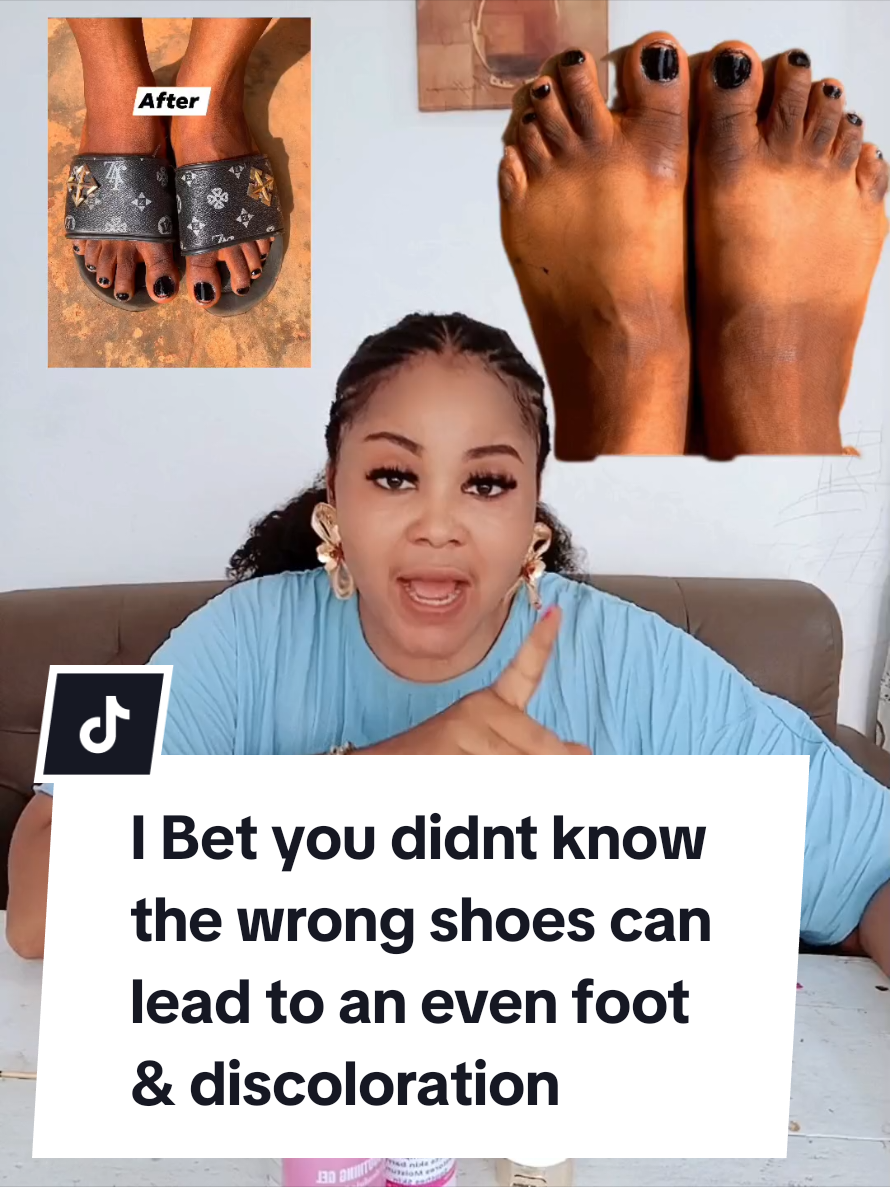 @Trishglow