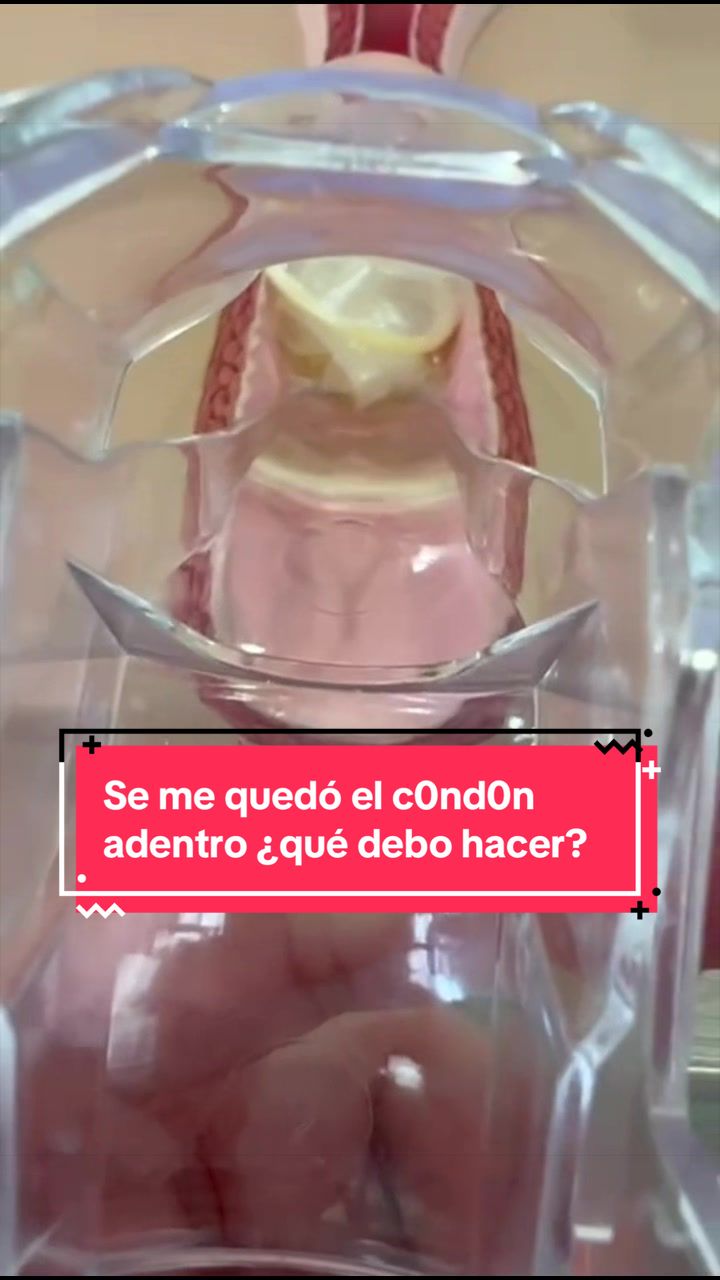 @Dra. Verónica Reyes Ginecóloga