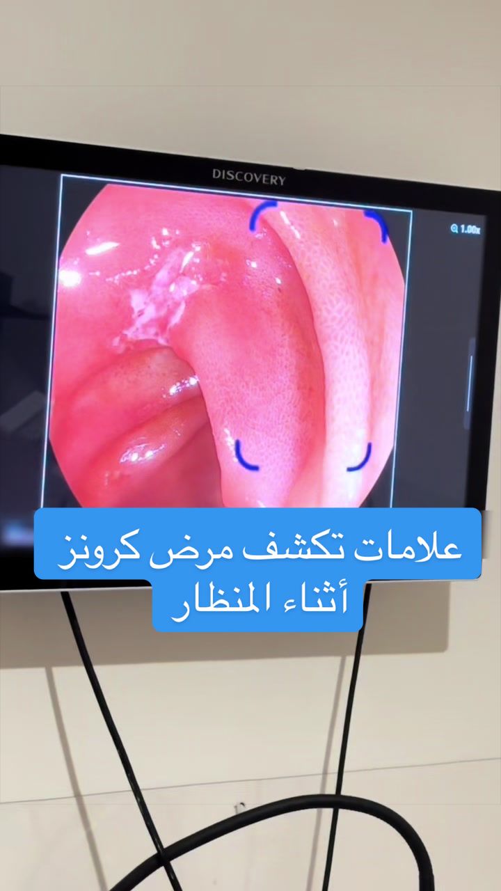 @مركز الجهاز الهضمي المتكامل