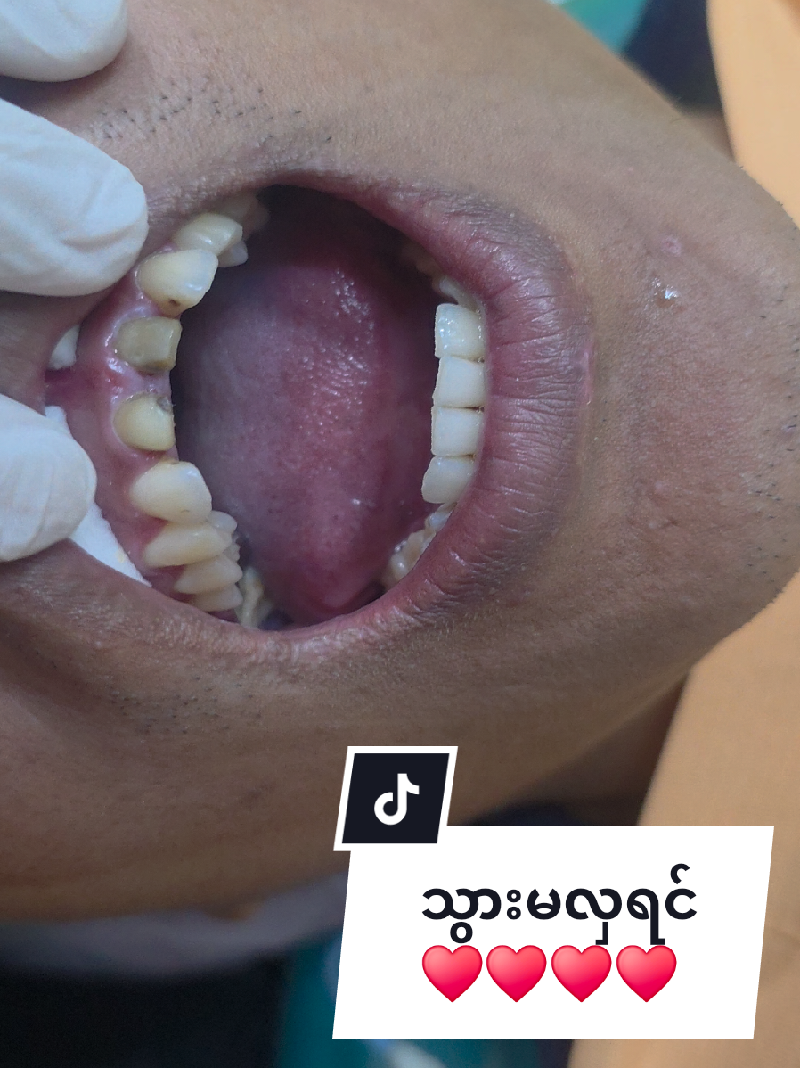 @Dr.KoKoSawMin(သွားဆရာဝန်)