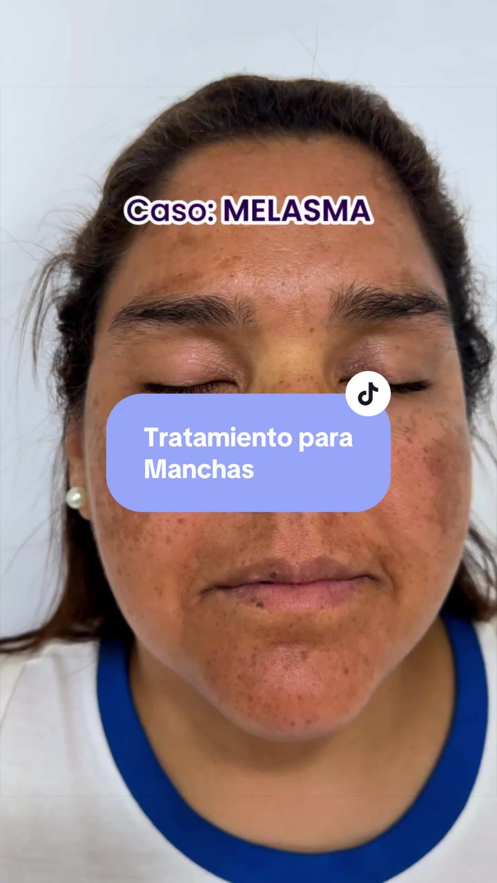 @Dr Christian Palacios derma