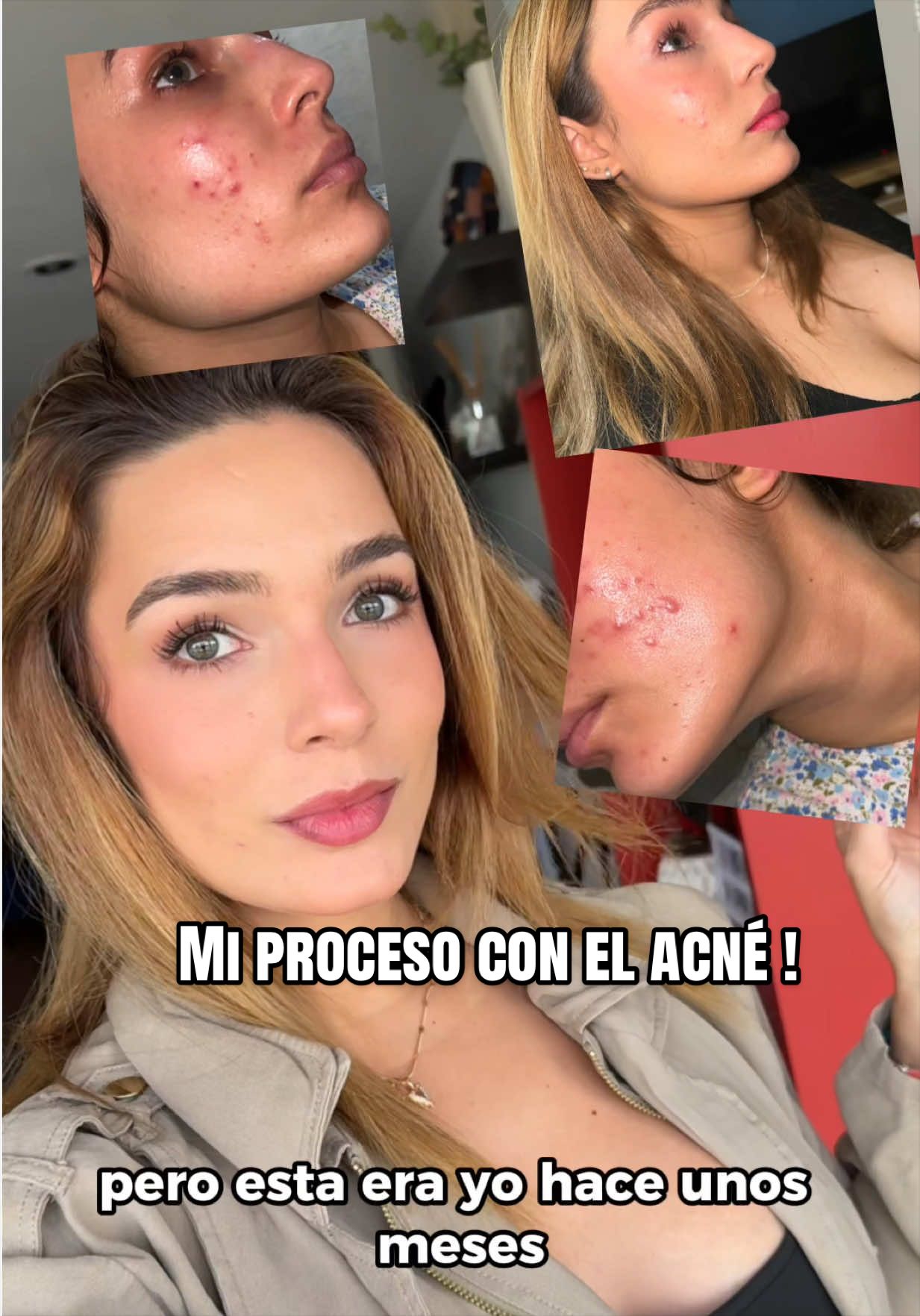 @Vanessa Silva Sperka