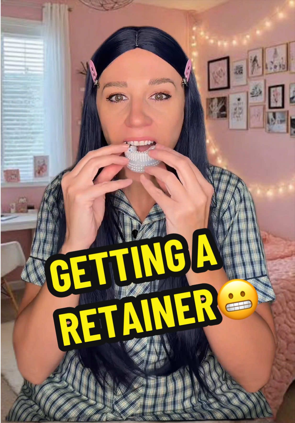 @Ally Aurora