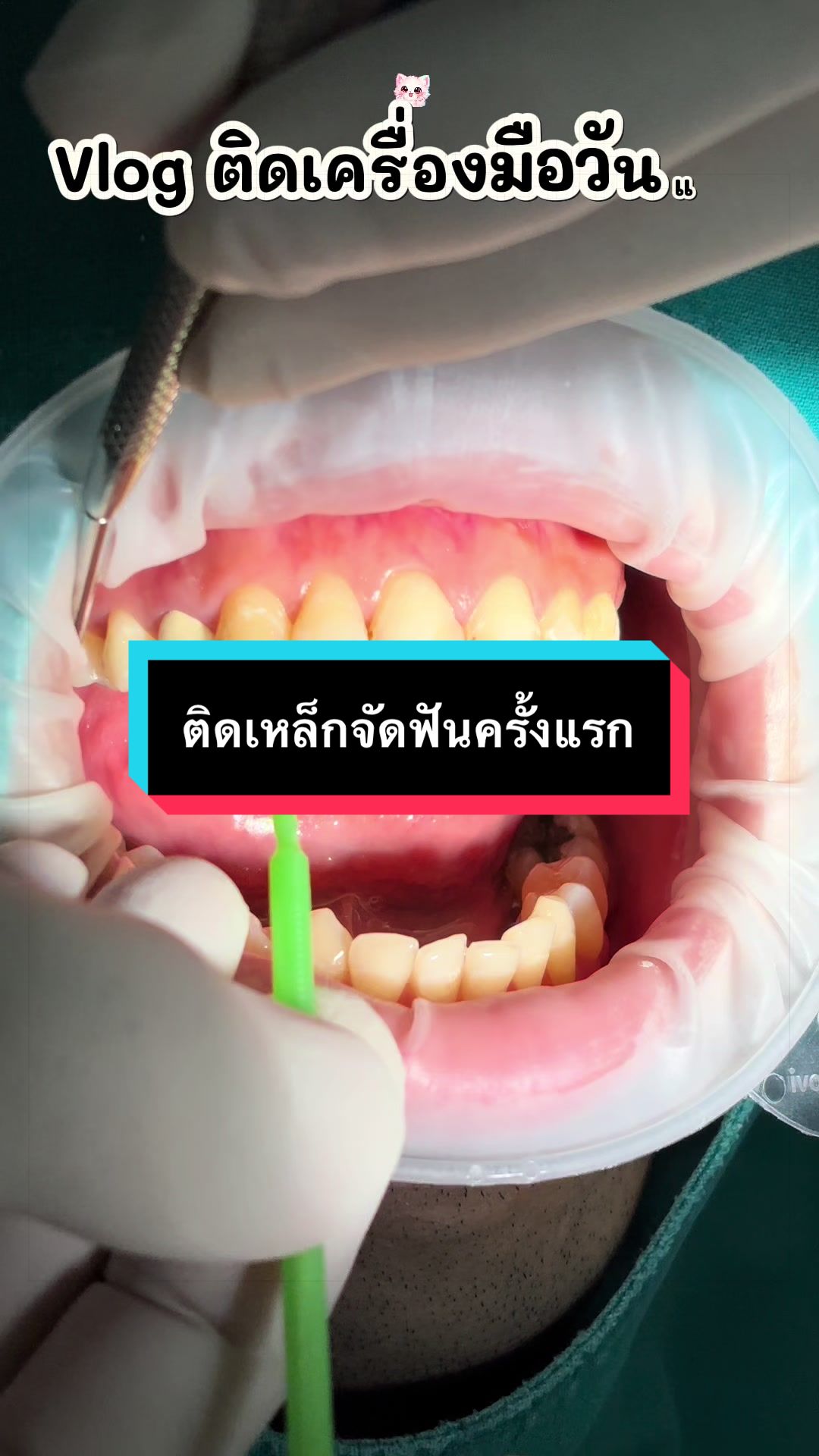 @ซอฟแอนด์สไมล์ลาดกระบัง