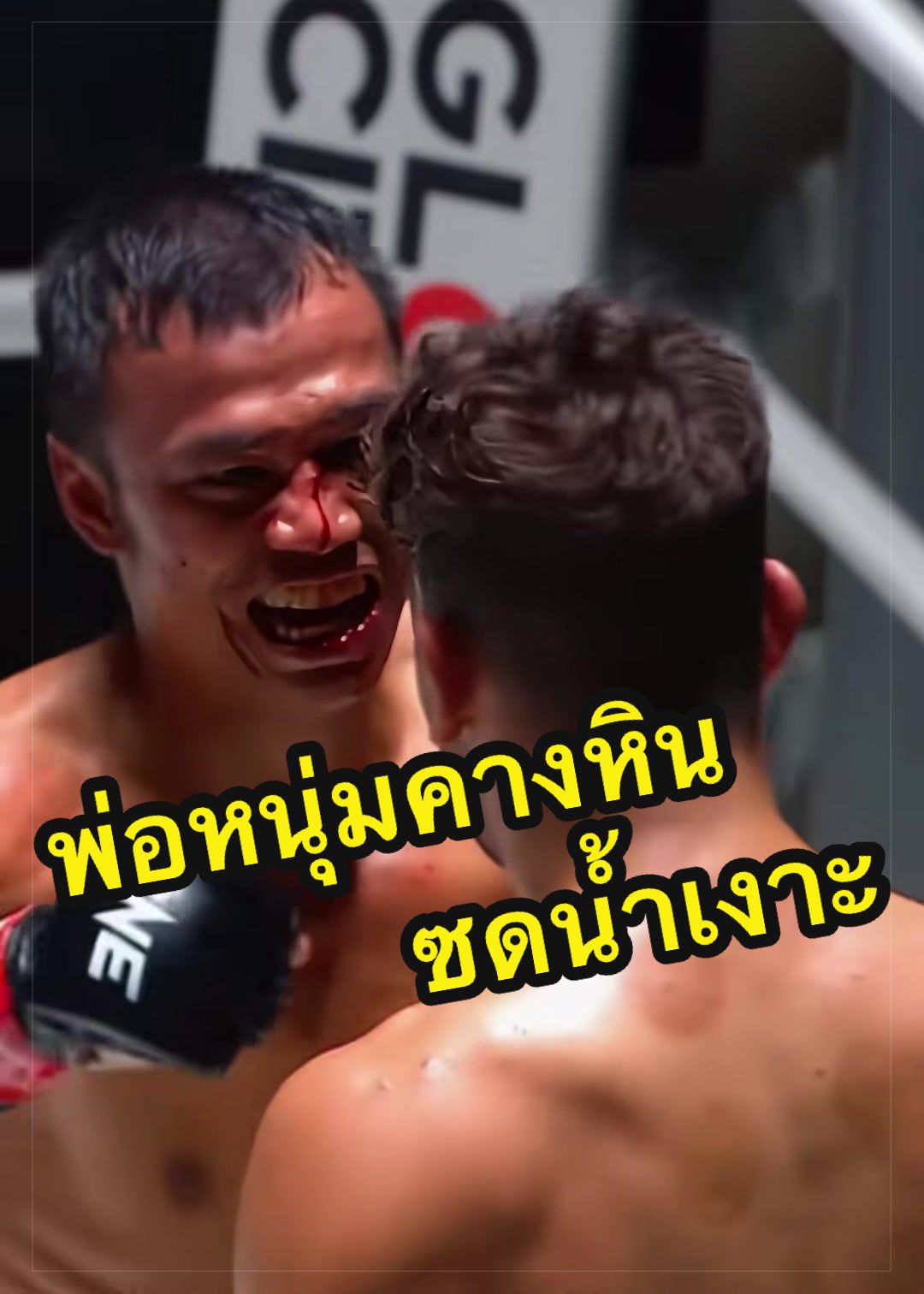 @การิว