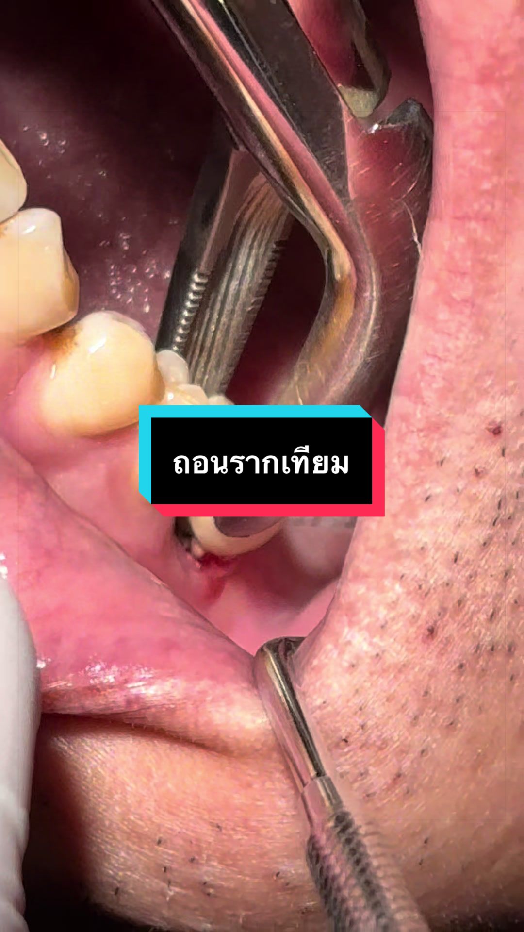 @ซอฟแอนด์สไมล์ลาดกระบัง