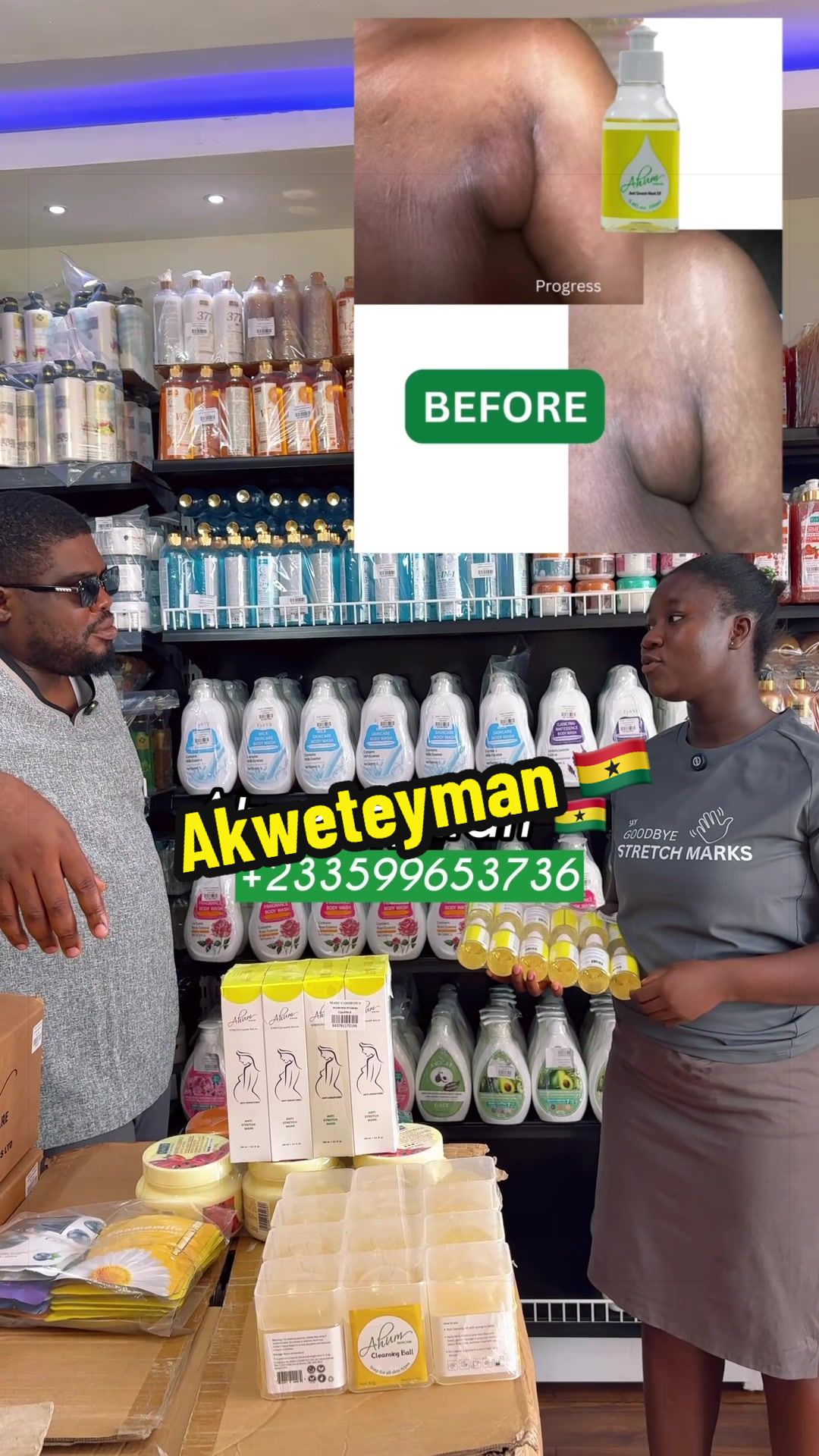 @No1 STRETCH MARKS PRODUCT
