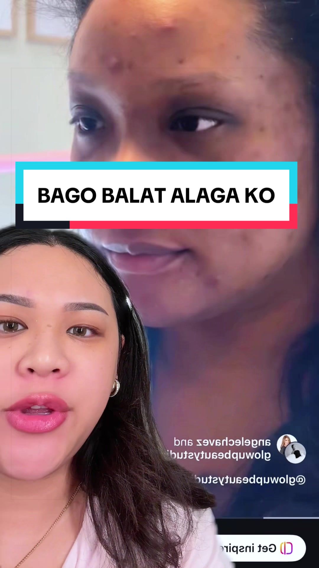 @Angel Echavez