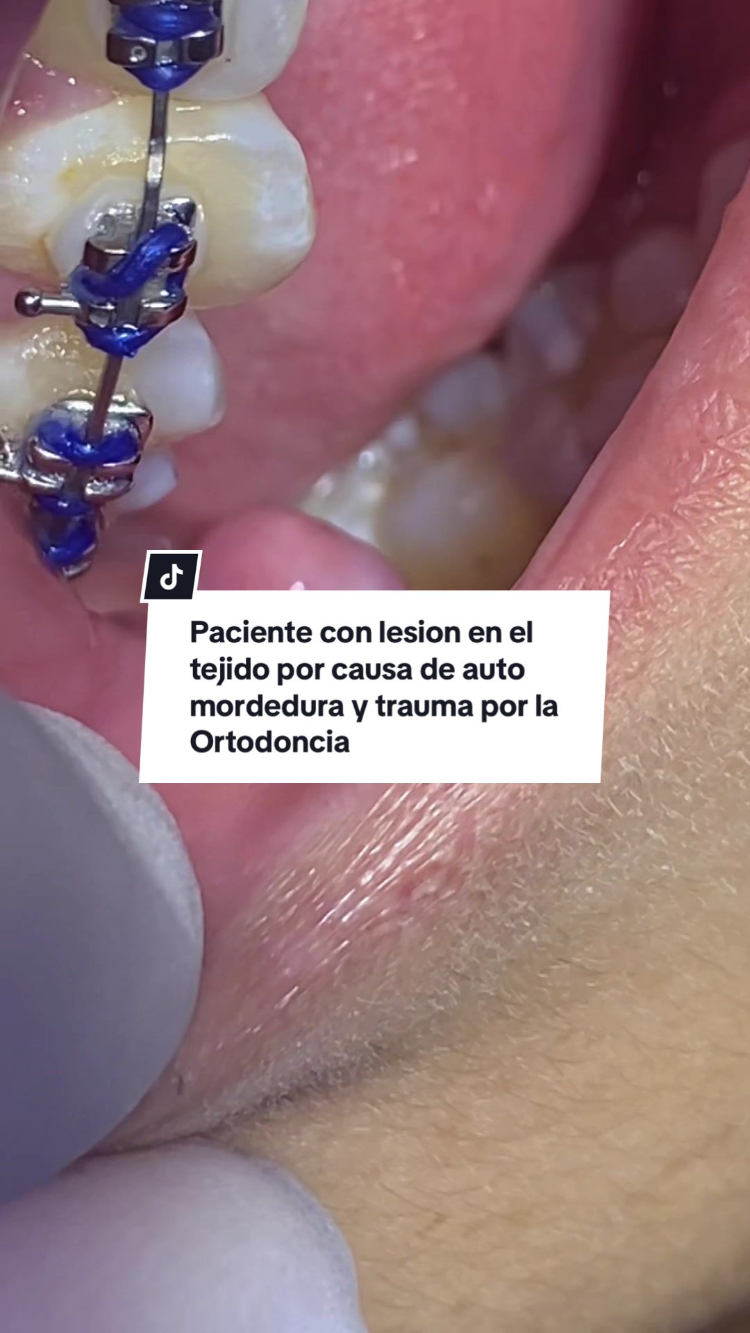 @Dralizbonilla