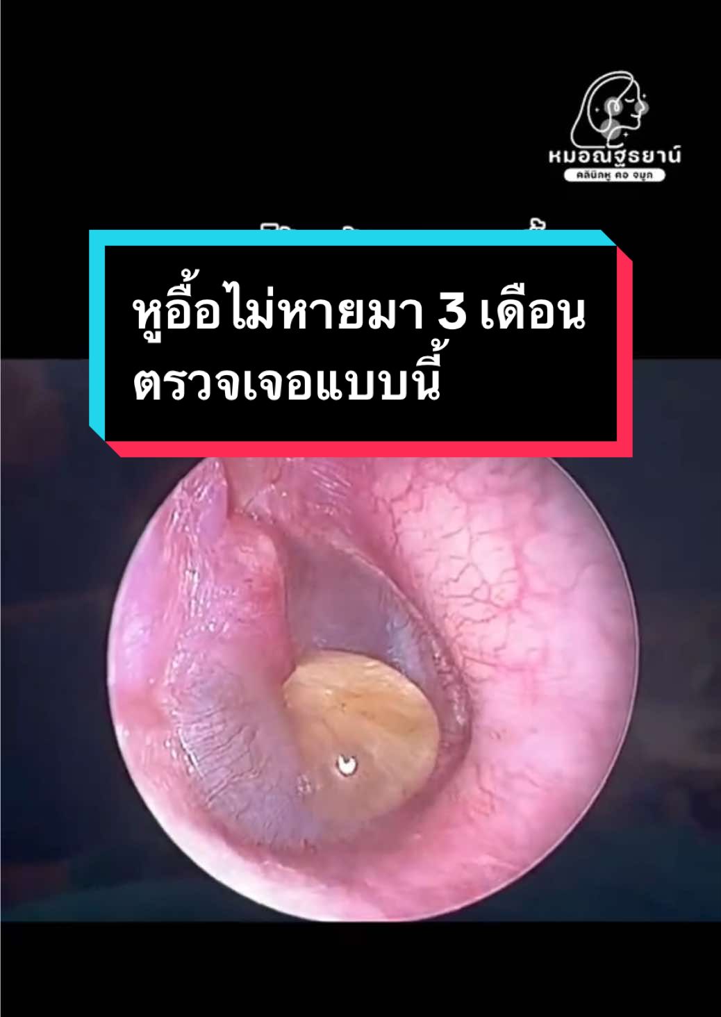 @คลินิกหมอณัฐธยาน์ หู คอ จมูก
