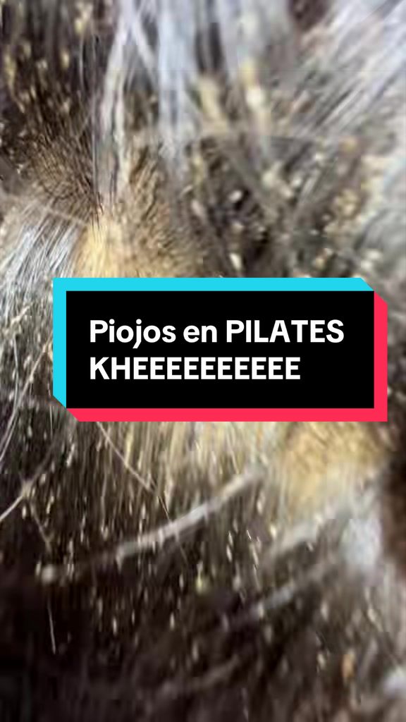 @Pppicas