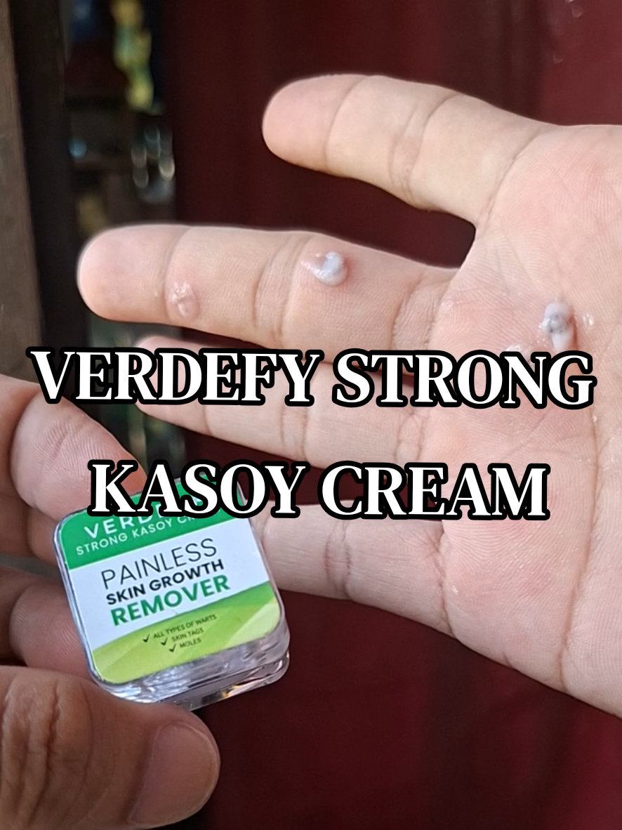 @𝚛𝚎𝚗𝚣𝚒𝚎𝚎