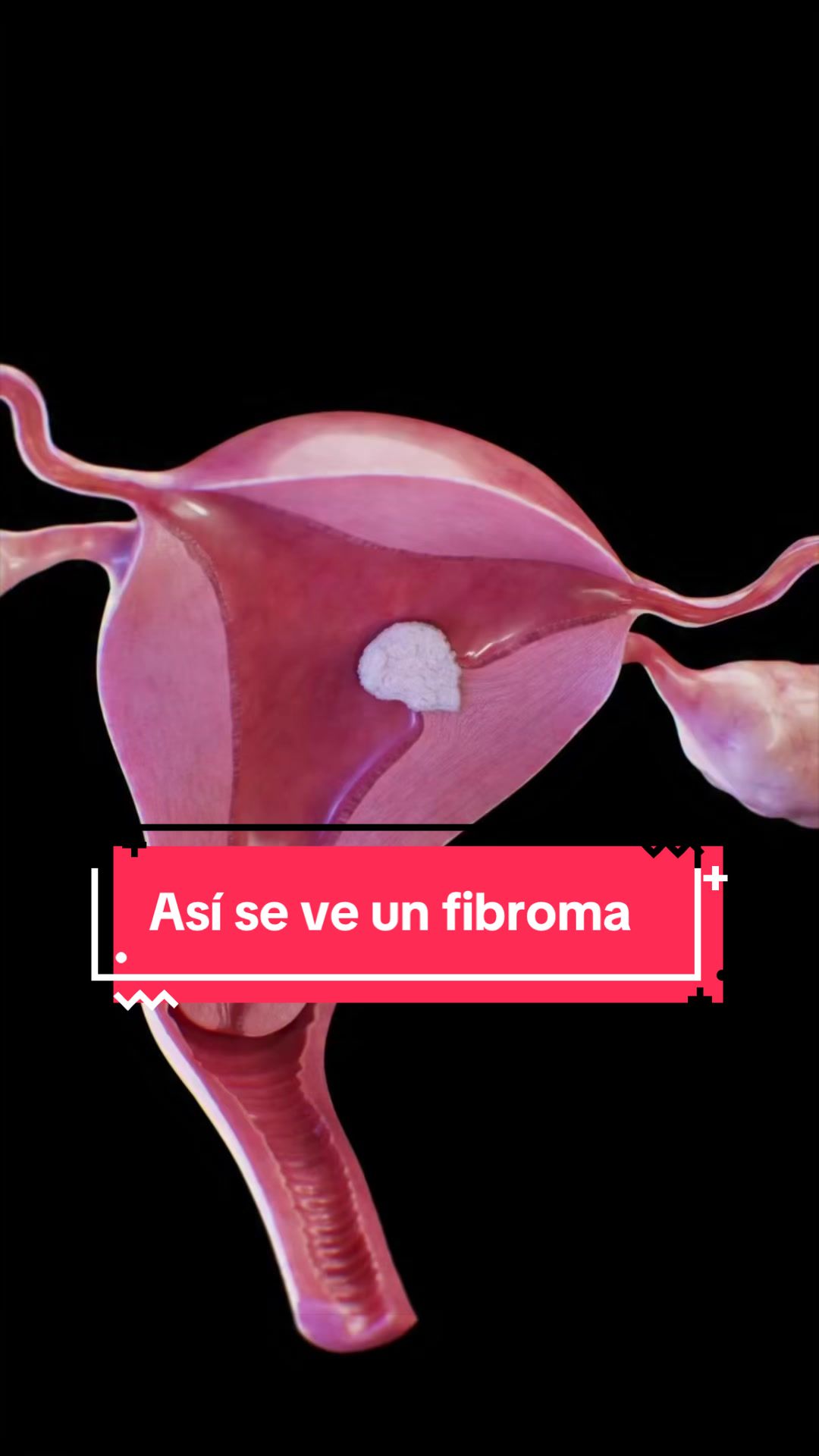 @Dra. Verónica Reyes Ginecóloga