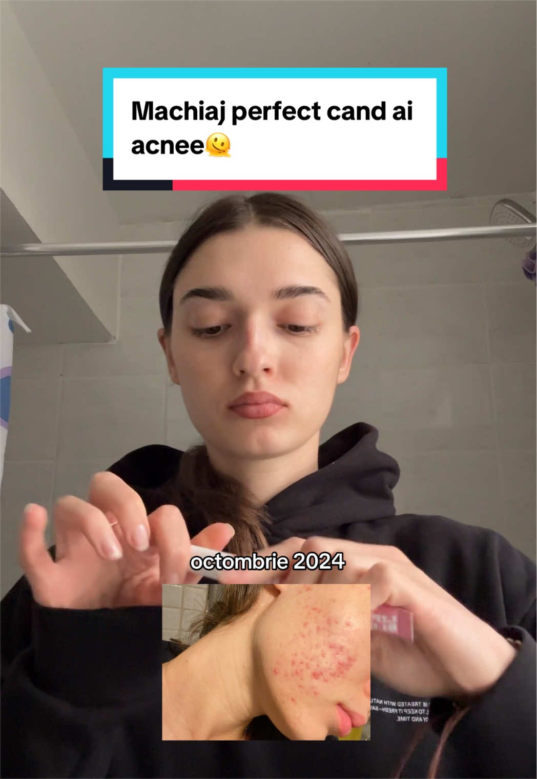 @Alyy_nna | Acne Fighter 🐞