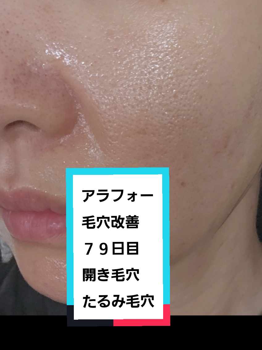 @リアル毛穴改善記録