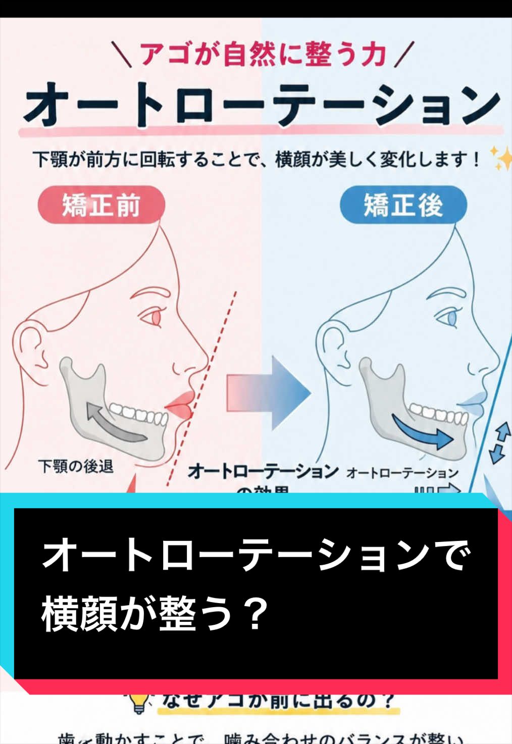@Emichi