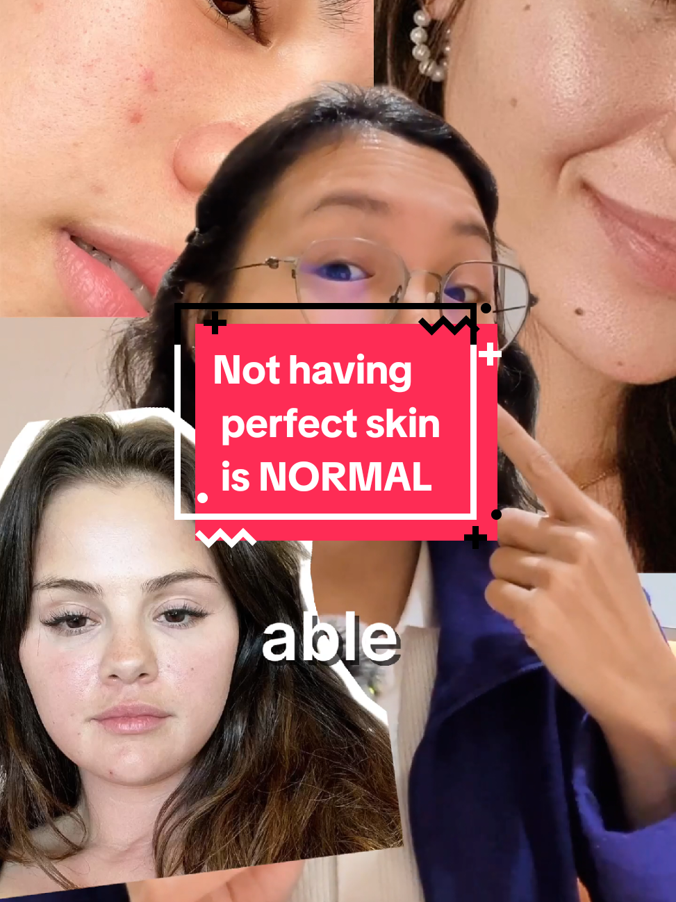 @Grace | TSW & Eczema Recovery