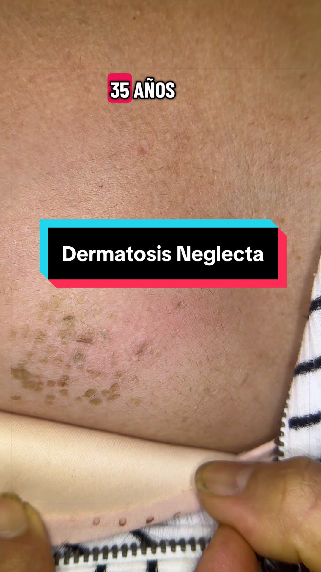 @Dr. Wilfrido Solano Derma