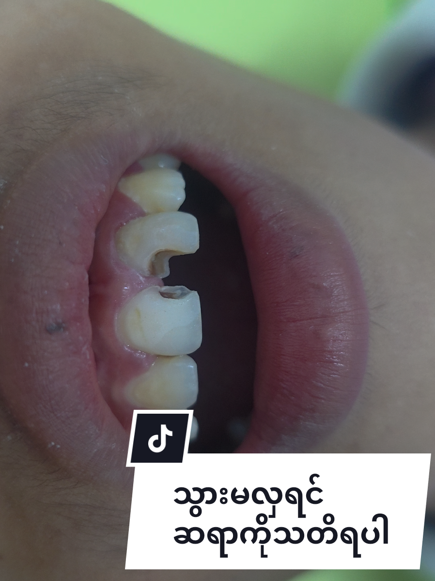 @Dr.KoKoSawMin(သွားဆရာဝန်)